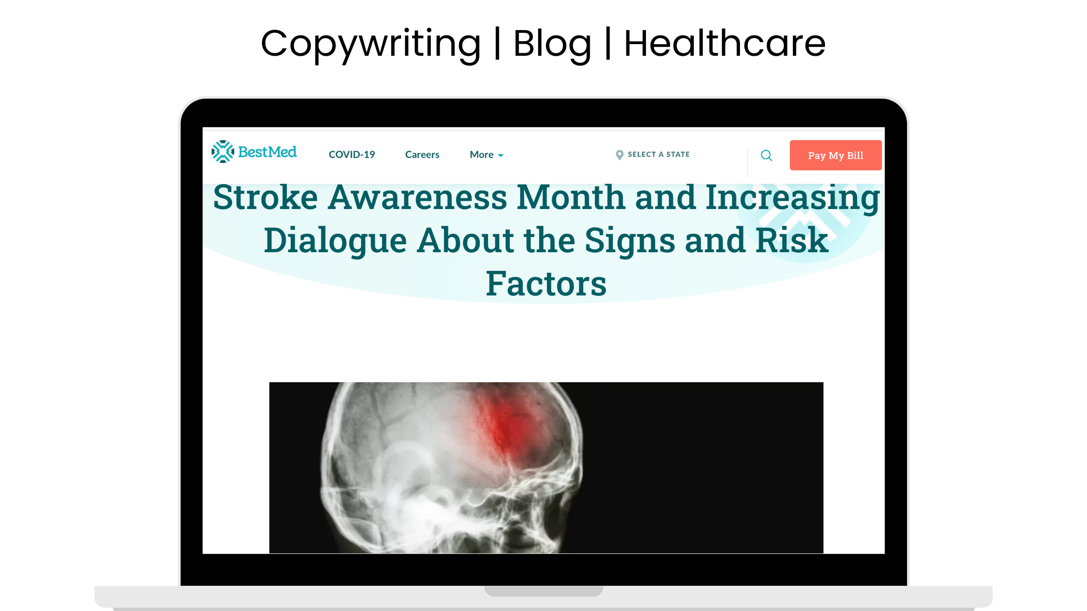 Stroke Awareness Month Dialogue and Risk Factors